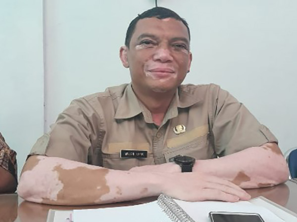 Teknik Ampuh Mengatasi Gangguan Kelistrikan Dengan Pemahaman Aliran Arus Listrik Teknik Ampuh Mengatasi Gangguan Kelistrikan Dengan Pemahaman Aliran Arus Listrik